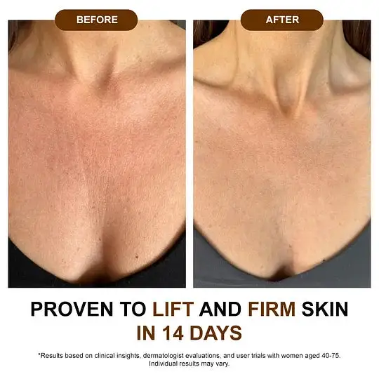 Silk Body Oil-Smooth Wrinkles & Firm Sagging Skin - Image 8