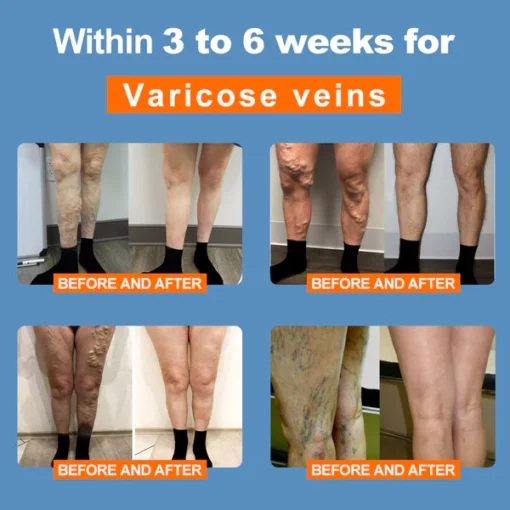 Ionic Ionized Low-Frequency Pulse Self-Heating Socks - Image 7