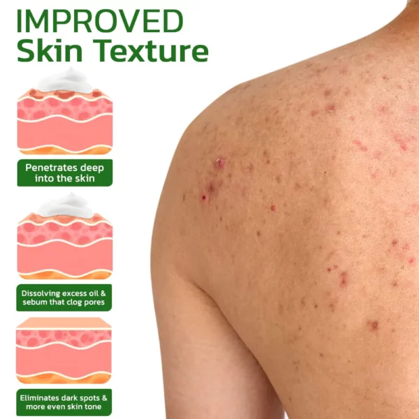 BodyTreat Collagen Exfoliating Essence - Image 5