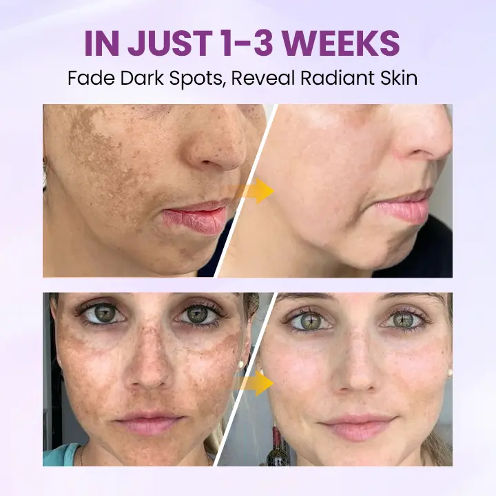 Radiant Clear Blemish & Brightening Serum - Image 4