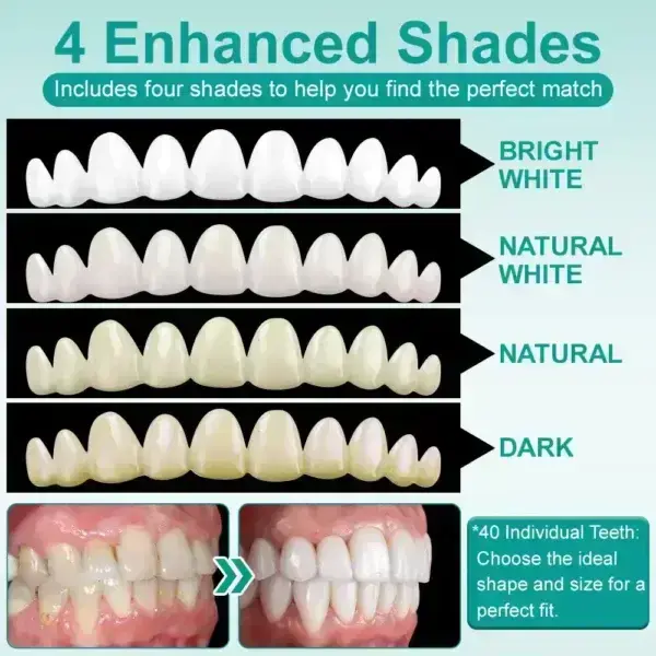 ๐๐ป๐๐๐ฎ๐ป๐ ๐ฆ๐๐ถ๐ฐ๐ธ-๐ผ๐ป ๐๐ฒ๐ป๐๐ฎ๐น ๐ฉ๐ฒ๐ป๐ฒ๐ฒ๐ฟ๐ (โ
Clinically proven, easy-to-use dental veneers trusted by over 8,000 US users for a comfortable, natural smile.) - Image 2