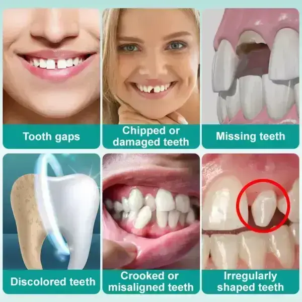 ๐๐ป๐๐๐ฎ๐ป๐ ๐ฆ๐๐ถ๐ฐ๐ธ-๐ผ๐ป ๐๐ฒ๐ป๐๐ฎ๐น ๐ฉ๐ฒ๐ป๐ฒ๐ฒ๐ฟ๐ (โ
Clinically proven, easy-to-use dental veneers trusted by over 8,000 US users for a comfortable, natural smile.) - Image 7