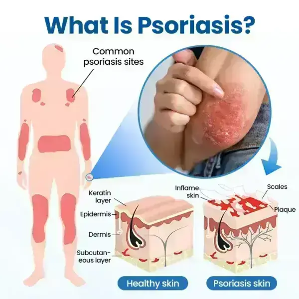 PCA Magnesium Deep Repair Spray - Image 11