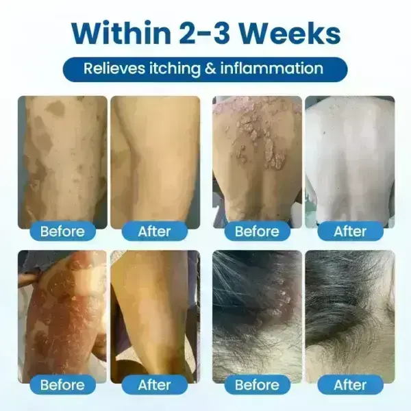 PCA Magnesium Deep Repair Spray - Image 6