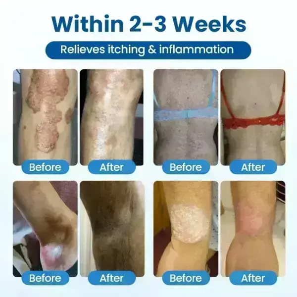 PCA Magnesium Deep Repair Spray - Image 7