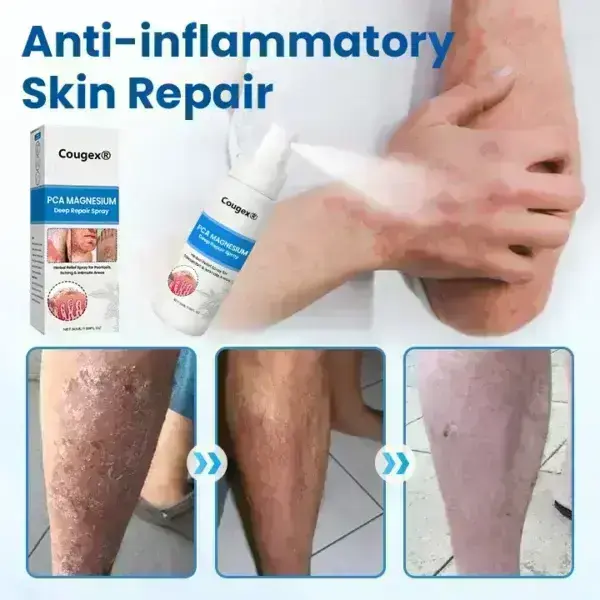 PCA Magnesium Deep Repair Spray - Image 9