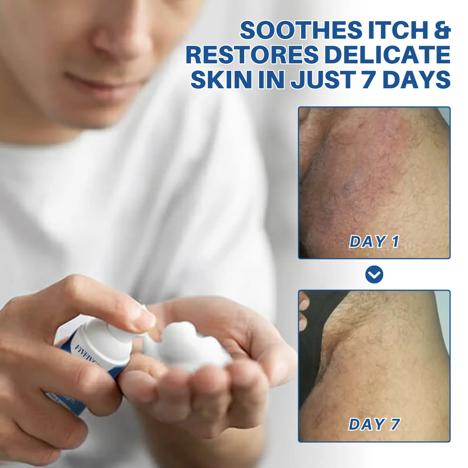 Advanced HPV & Rash Relief Genital Foam - Image 4