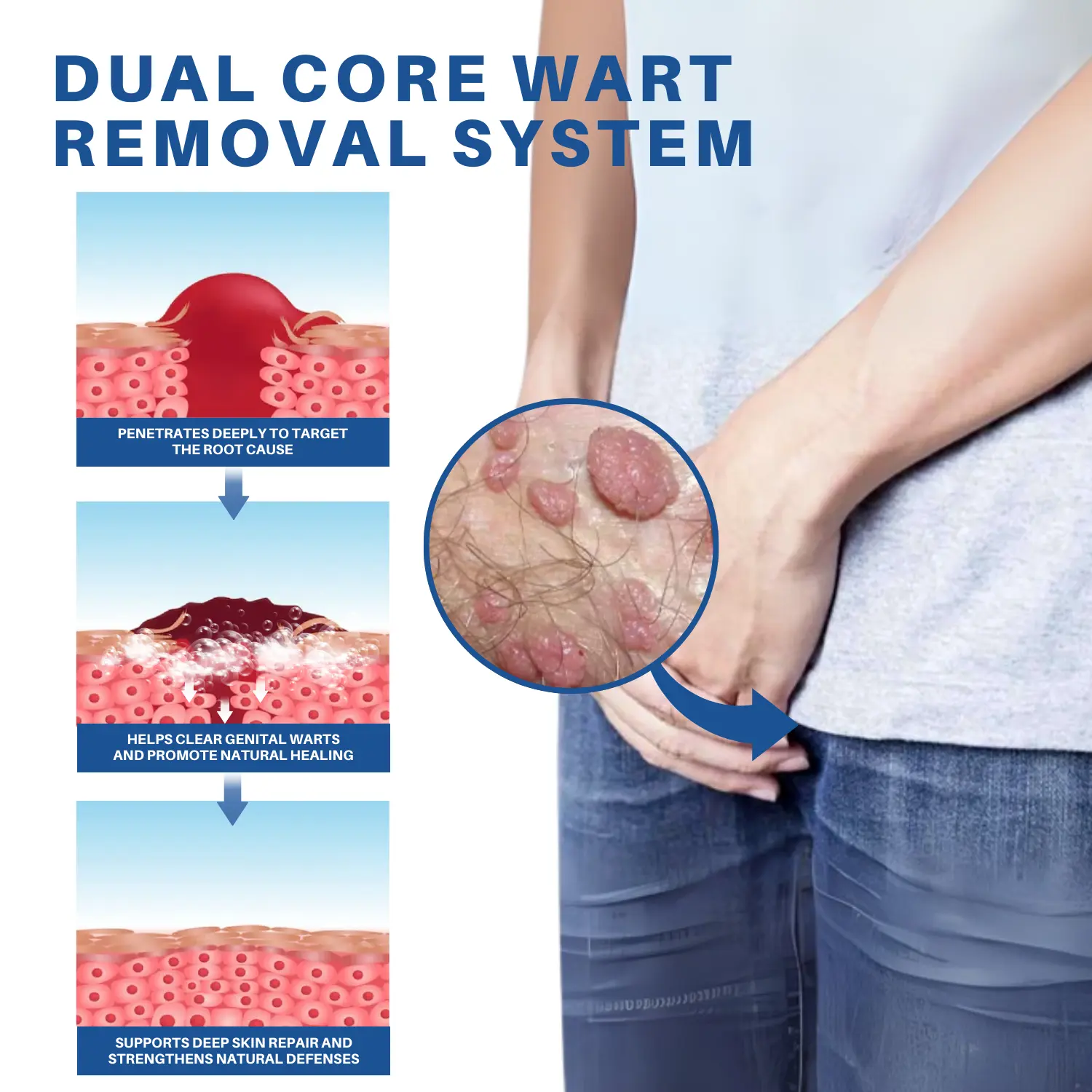 Advanced HPV & Rash Relief Genital Foam - Image 5