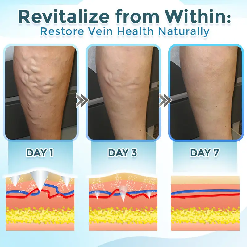 VenaRestore MicroNeedle Vein Repair Patch - Image 5