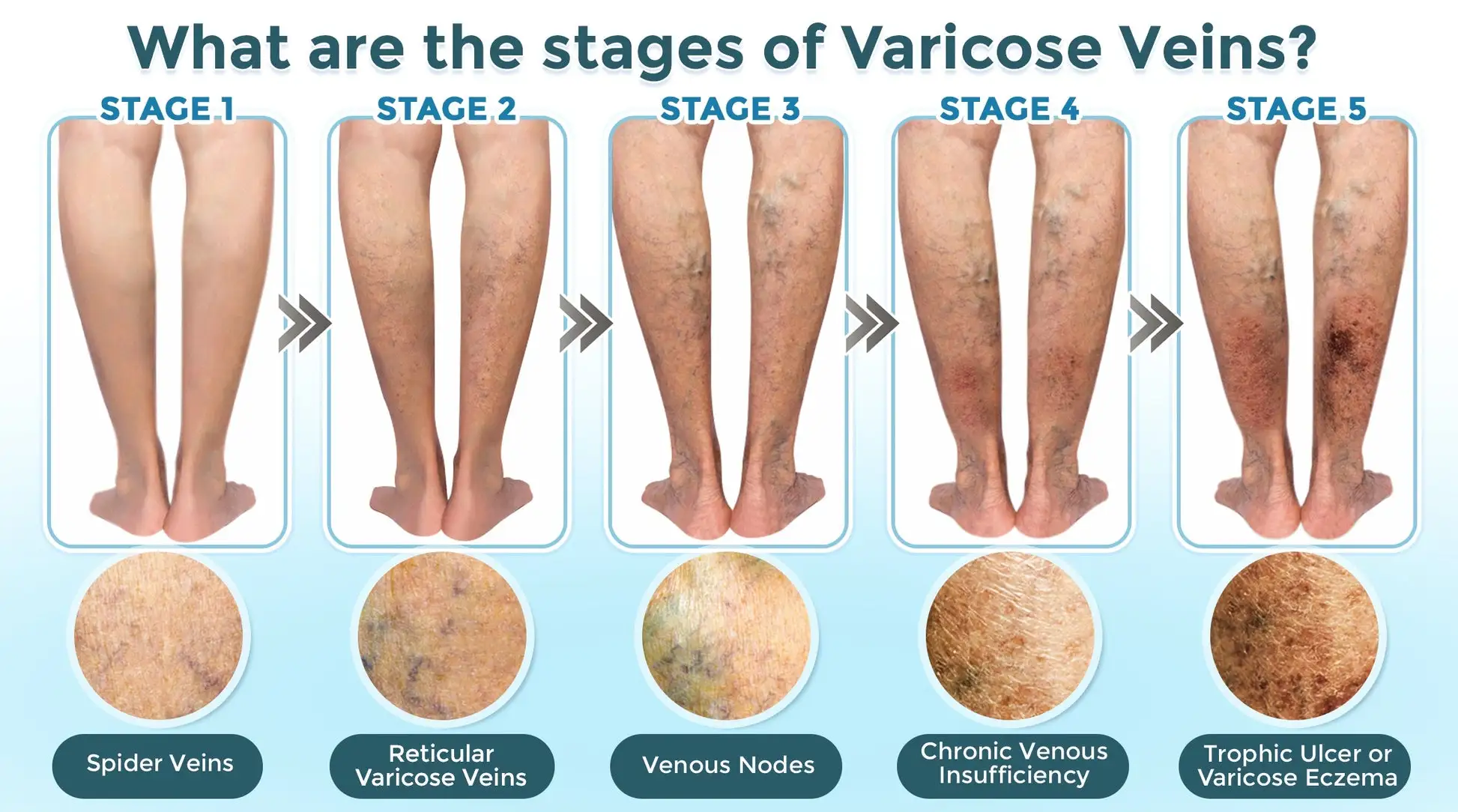 VenaRestore MicroNeedle Vein Repair Patch - Image 3