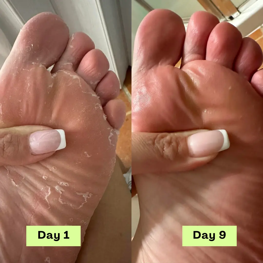 AntiFungal Relief Soap Bar - Image 3