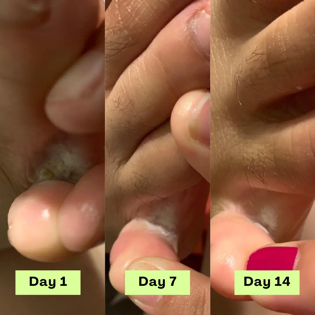 AntiFungal Relief Soap Bar - Image 5