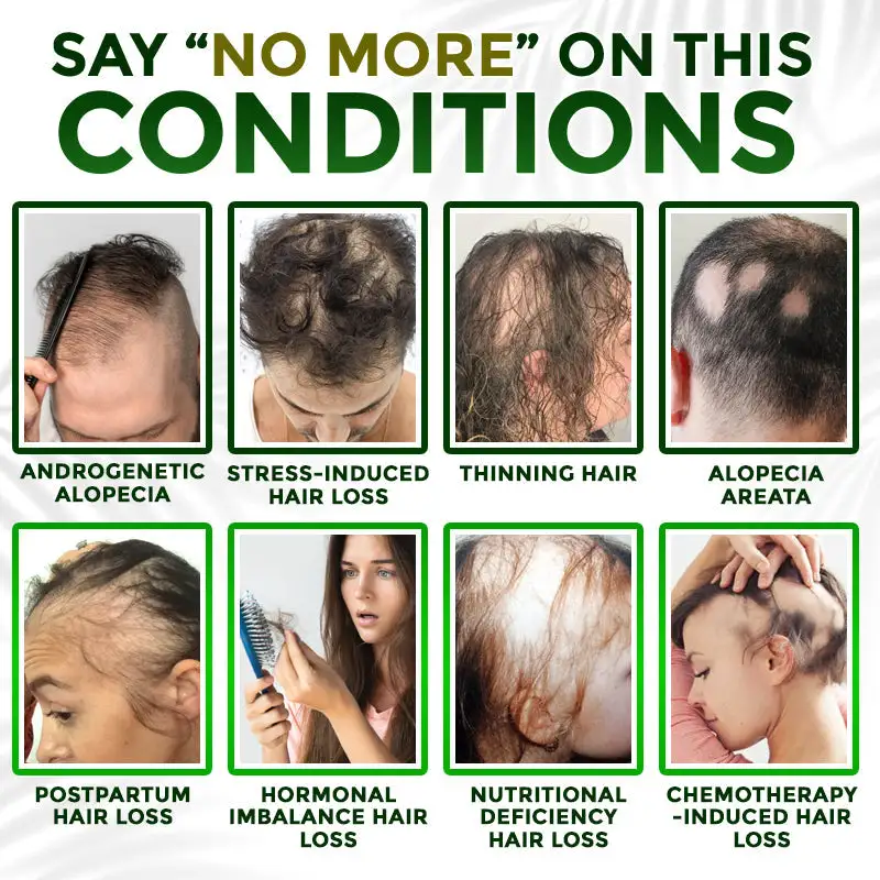 Microneedle Herbal Infusion Hair Stimulation Set - Image 2