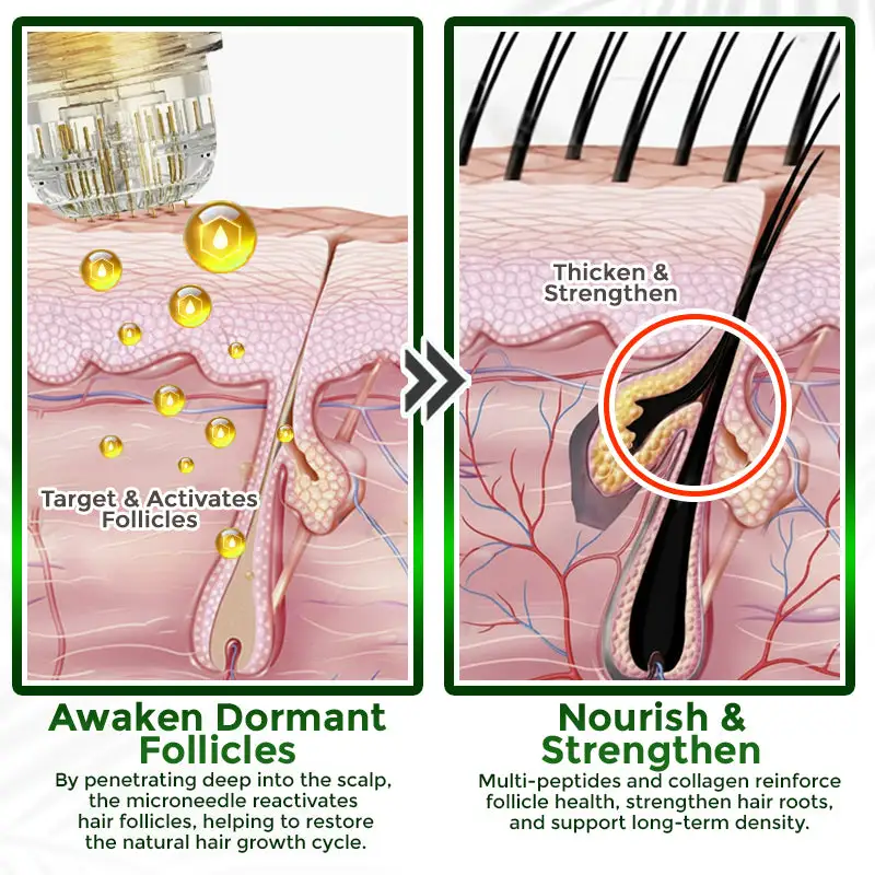 Microneedle Herbal Infusion Hair Stimulation Set - Image 5