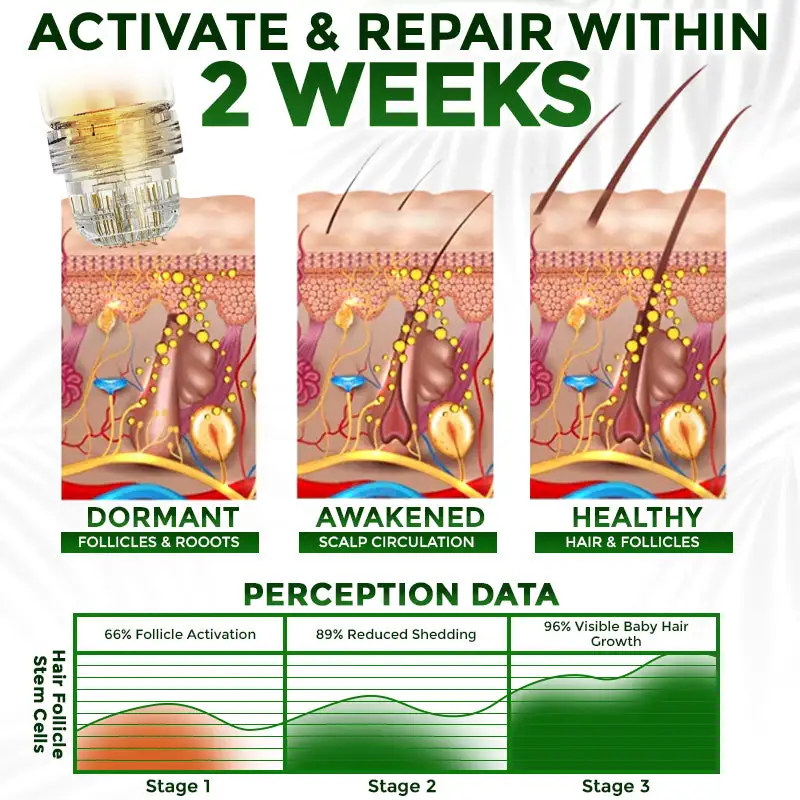 Microneedle Herbal Infusion Hair Stimulation Set - Image 6