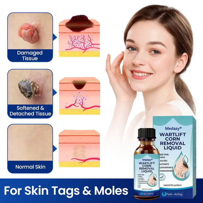 WartLift Corn Removal Liquid - Image 7