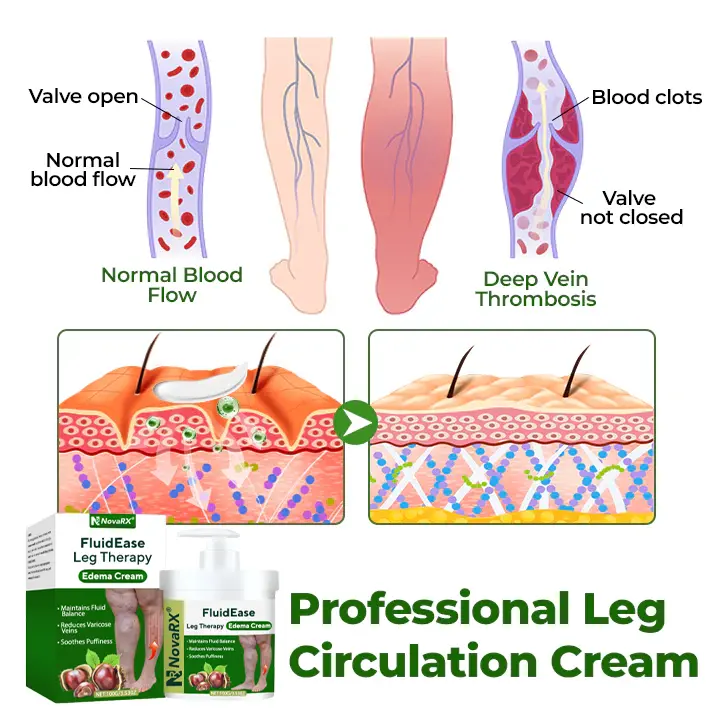 FluidEase Leg Therapy Edema Cream - Image 4