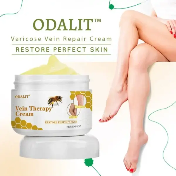 Vein Therapy Cream - Image 2