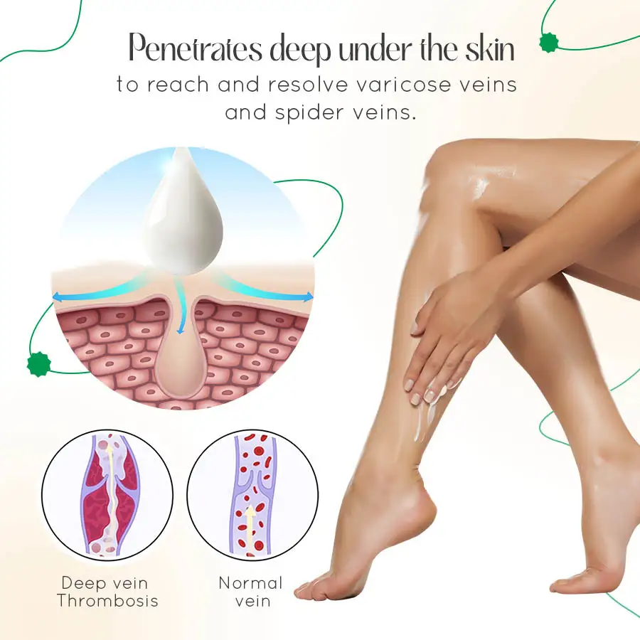 Vein Therapy Cream - Image 2