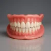 【OFFICIAL Custom-Fit Full Functional Dentures
