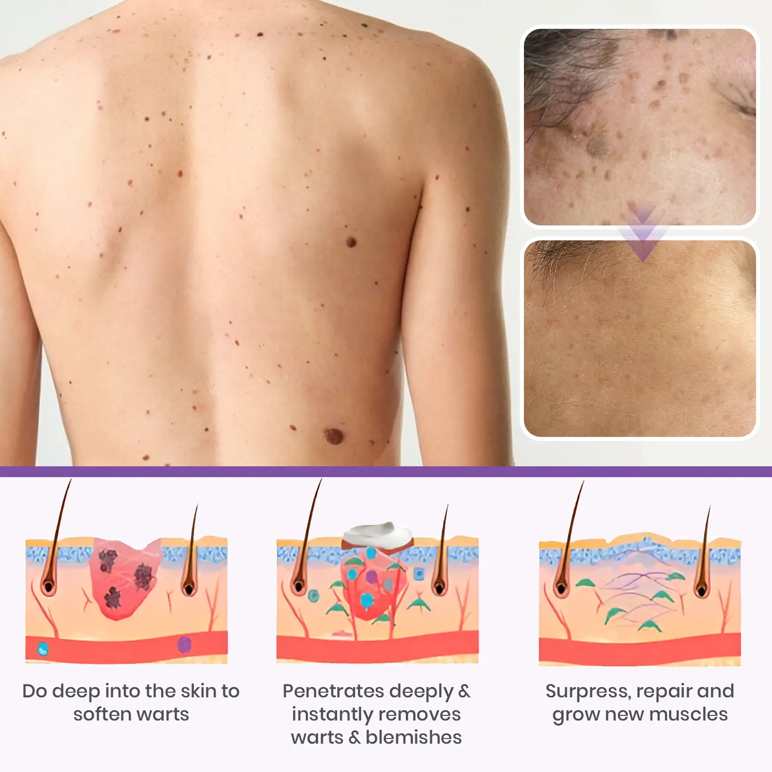 ✅ Official Store: Clarivine Dissolver Mole & Dark Spot Removal Bio-Gel - Image 11