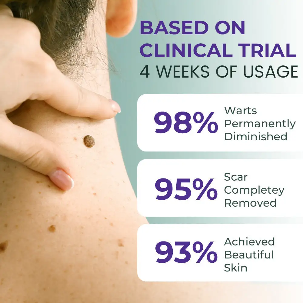 ✅ Official Store: Clarivine Dissolver Mole & Dark Spot Removal Bio-Gel - Image 7