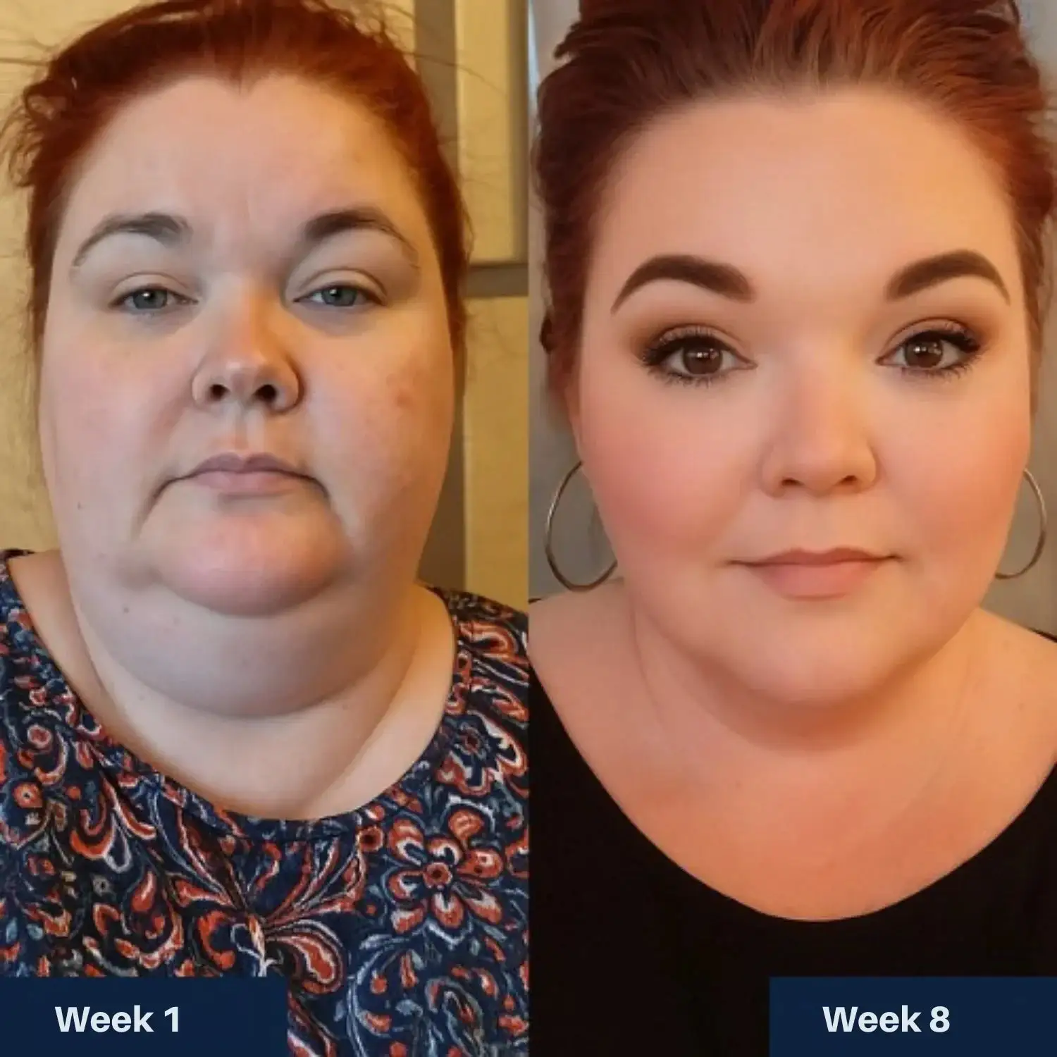 Weight Management Patches Pro - Image 11