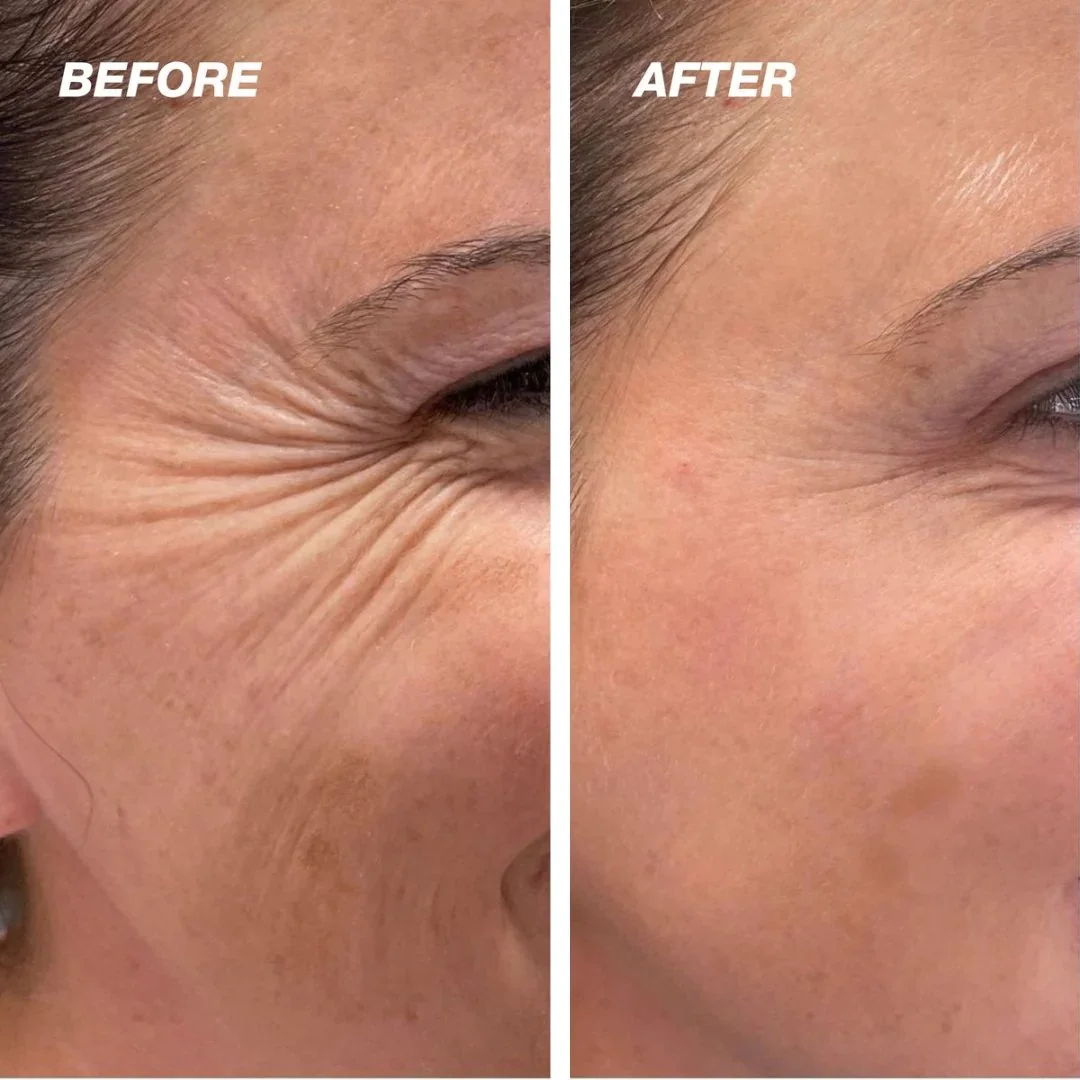 The Vita A Retinal Shot Tightening Booster - Image 8