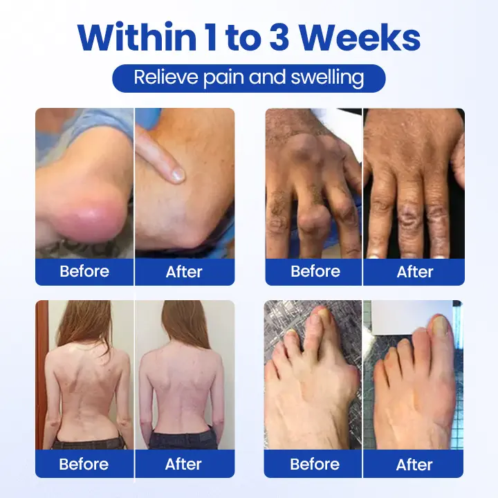 BPC-157 Joint&Bone Repair Roll-On Gel - Image 10