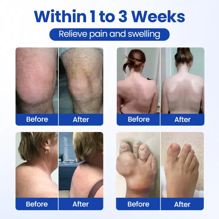 BPC-157 Joint&Bone Repair Roll-On Gel - Image 11