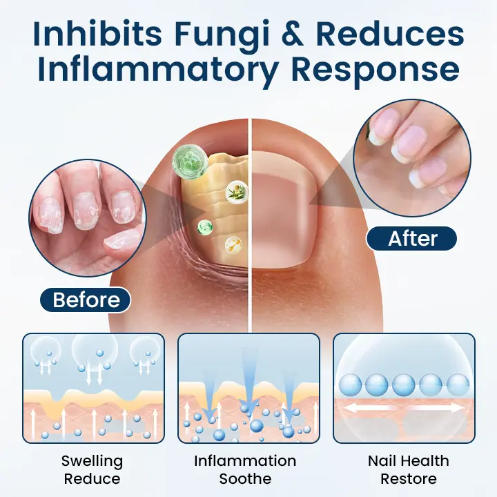 OnyxiGuard Fungal Repair Herbal Spray - Image 3