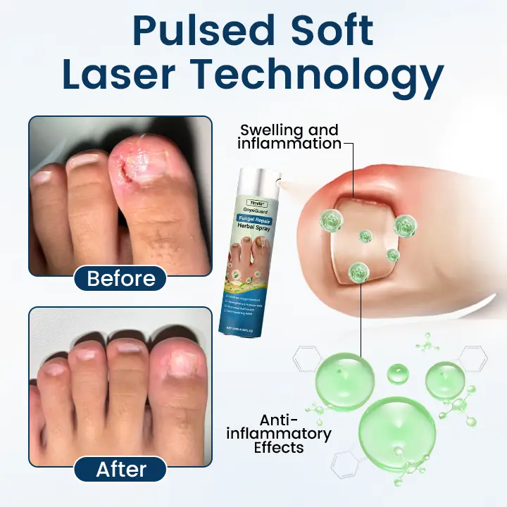 OnyxiGuard Fungal Repair Herbal Spray - Image 5