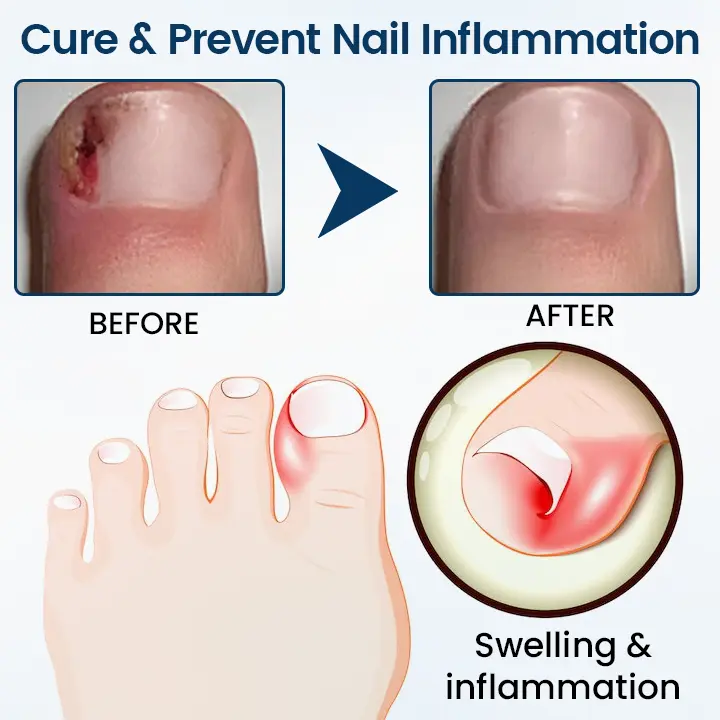 OnyxiGuard Fungal Repair Herbal Spray - Image 6