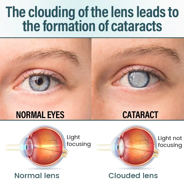 OptiFusion Nano Eye Drops Serum - Image 6