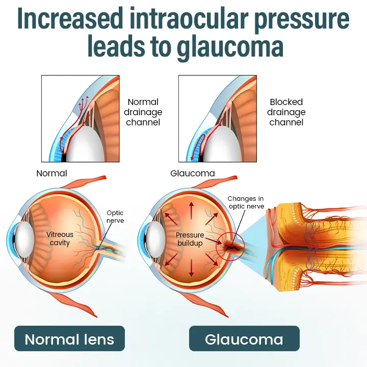 OptiFusion Nano Eye Drops Serum - Image 7