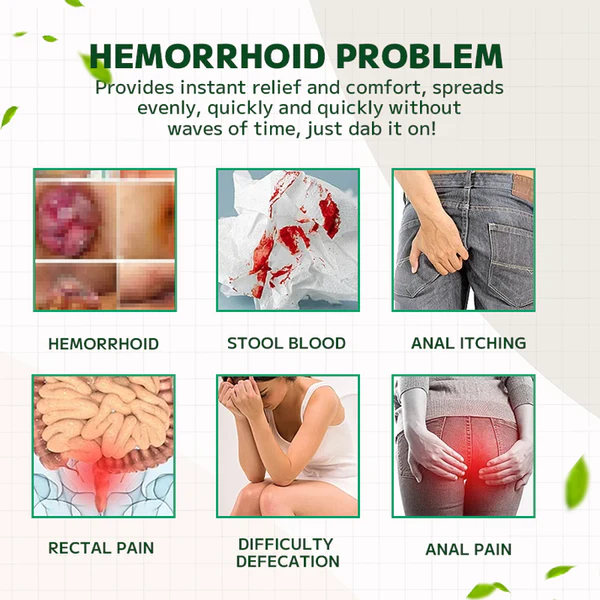 Maximum Strength Hemorrhoids and Fissure Ointment - Image 6