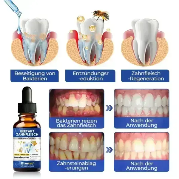BeeTakt Zahnfleisch-Repair Lösung - Image 10