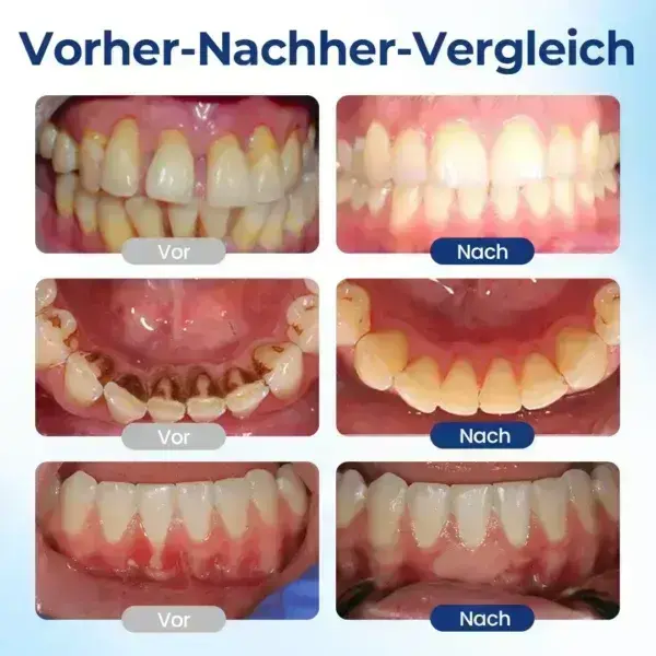 BeeTakt Zahnfleisch-Repair Lösung - Image 7