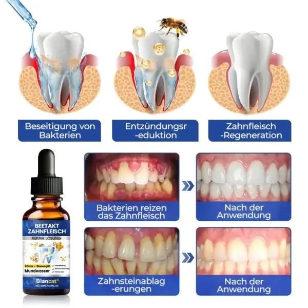 BeeTakt Zahnfleisch-Repair Lösung - Image 10