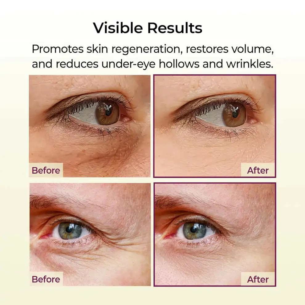 Calcium Multi Balm | Anti-Aging, Firming & Wrinkle Care - Image 7