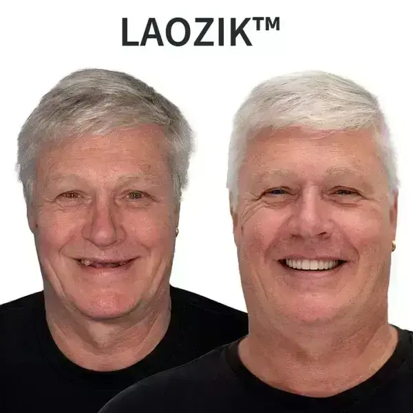đ„ LAOZIKTM Custom-Fit Functional Dentures â Made in the USA, Up to 70% OFF for a More Confident Smile!