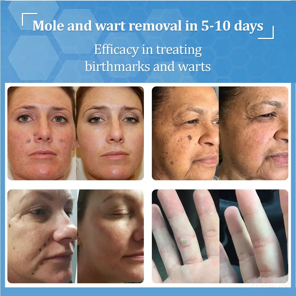 BeeDerm RX Cream - Image 9