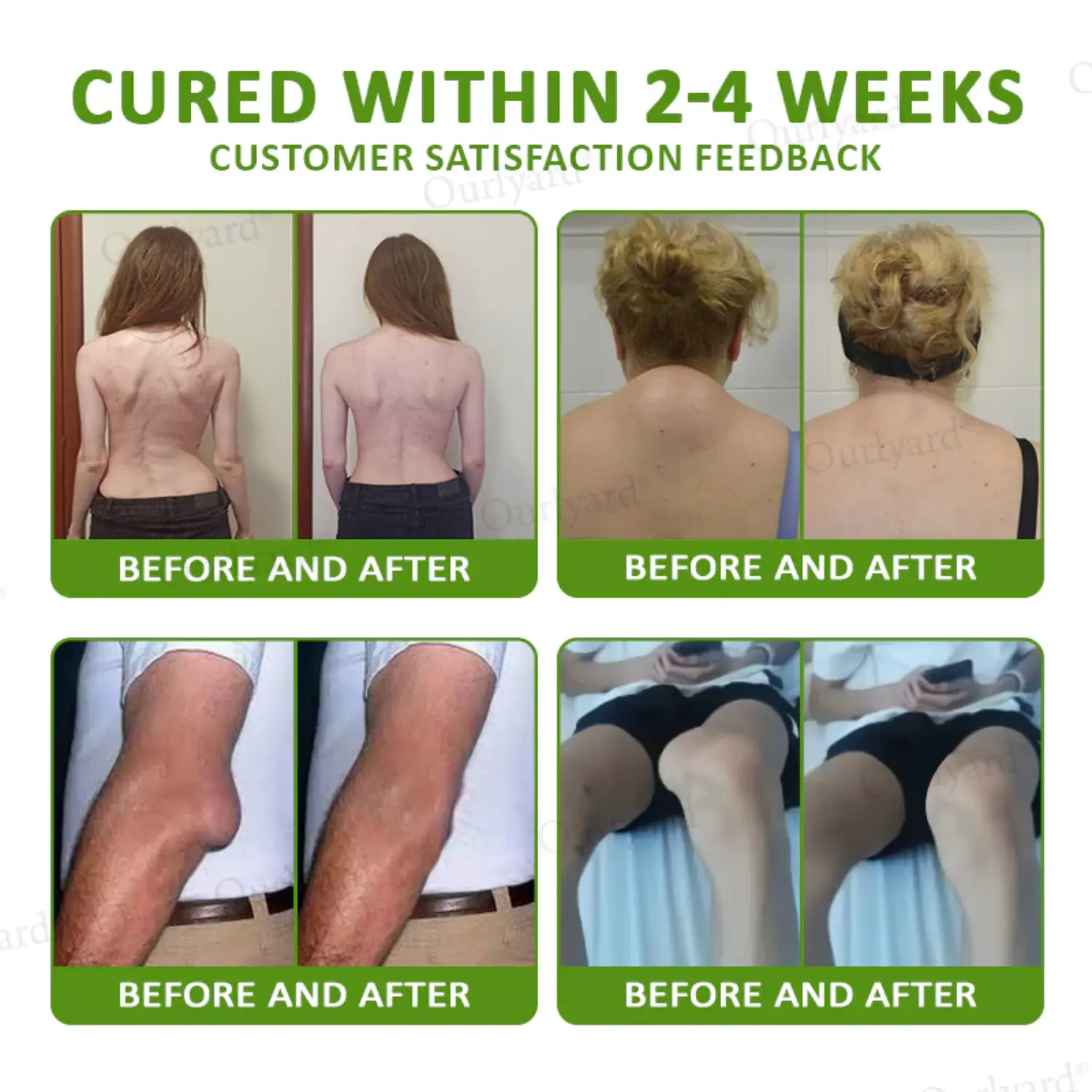 Magnesium & Peppermint Arthritis Pain Relief and Bone Healing Cream - Image 8