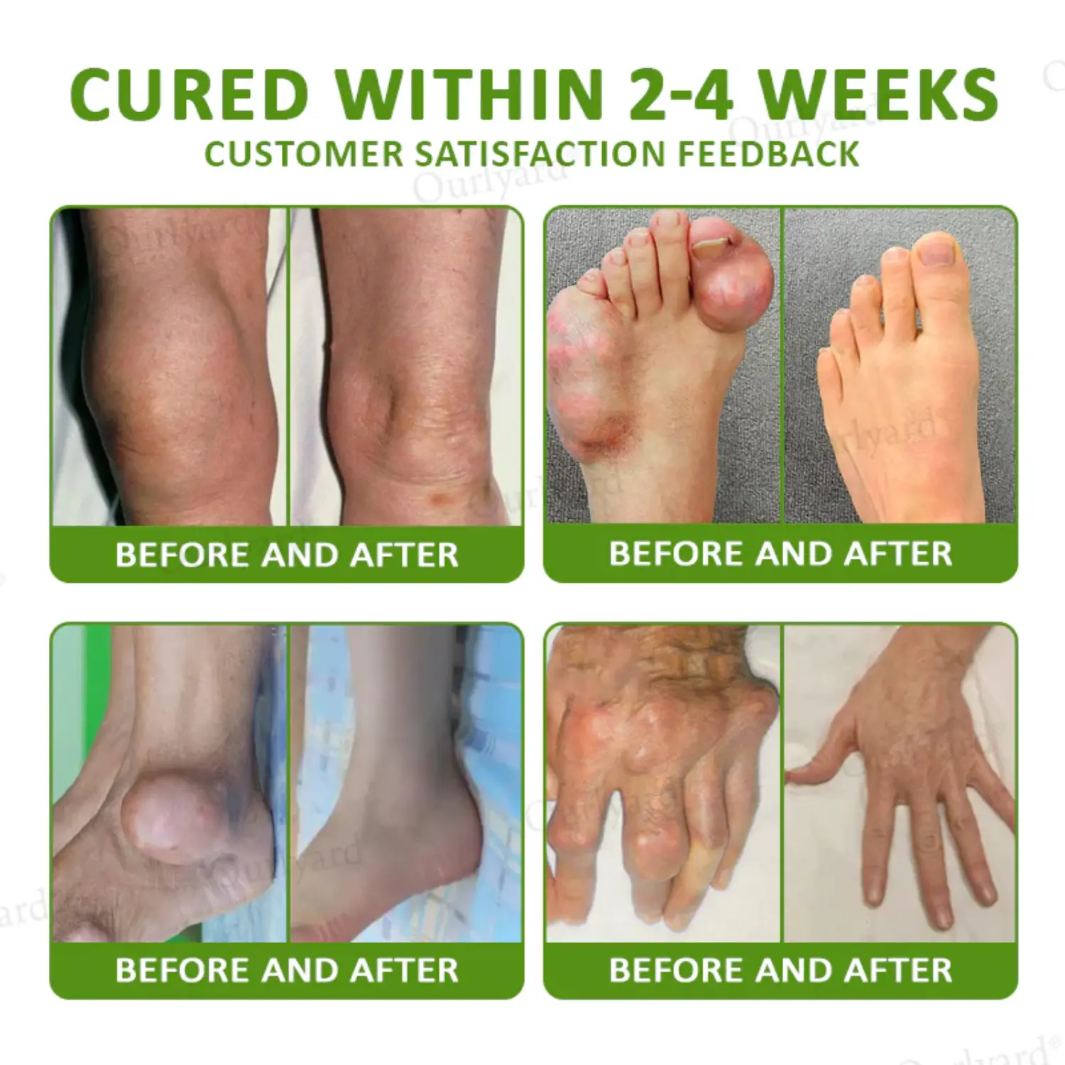 Magnesium & Peppermint Arthritis Pain Relief and Bone Healing Cream - Image 9