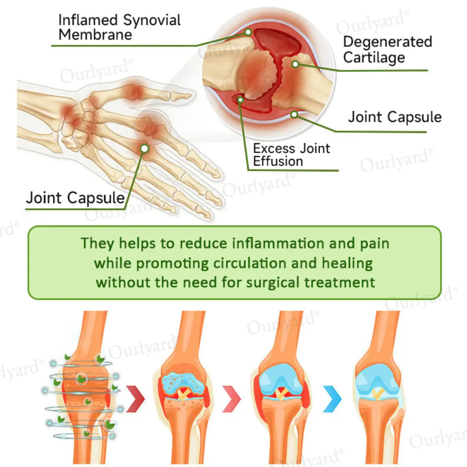 Magnesium & Peppermint Arthritis Pain Relief and Bone Healing Cream - Image 10