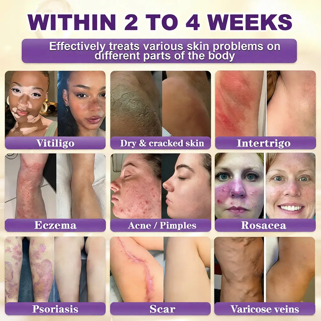 Biotin 10-in-1 Skin Restoration Cream - Image 2