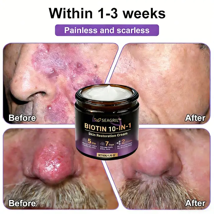 Biotin 10-in-1 Skin Restoration Cream - Image 8