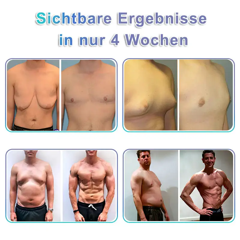 Gynecomastia Breast Fat Burning & Firming Patch - Image 2