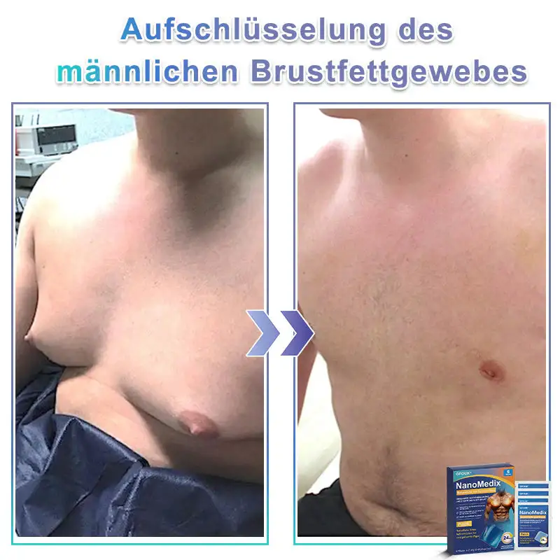 Gynecomastia Breast Fat Burning & Firming Patch - Image 4