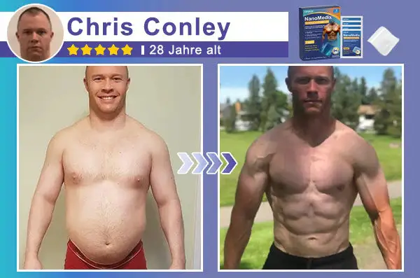 Gynecomastia Breast Fat Burning & Firming Patch - Image 5